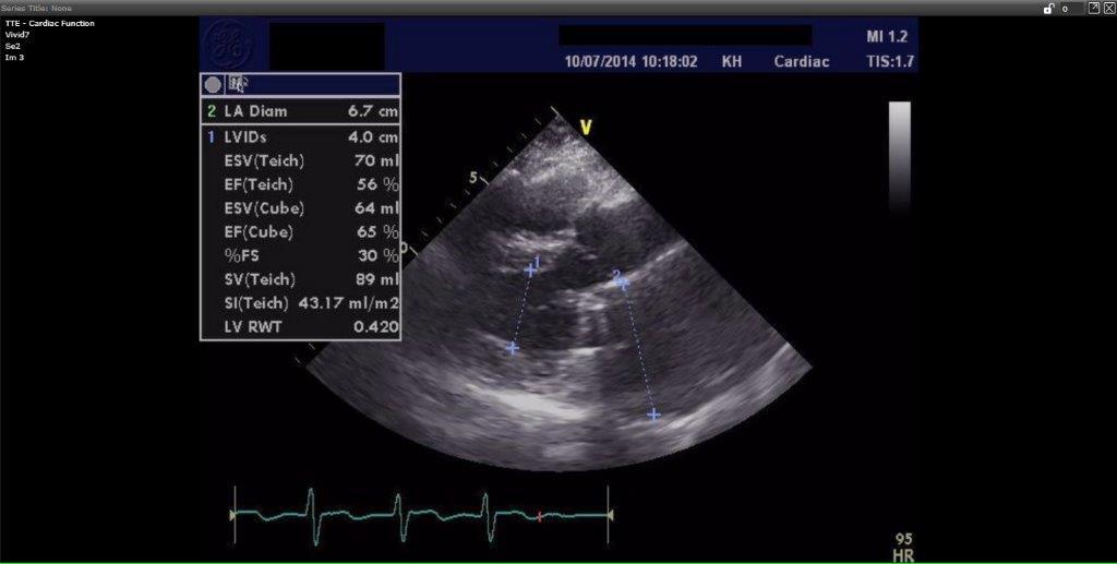 Learn more about CardioSR | CardioSR